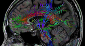 Neuroscience